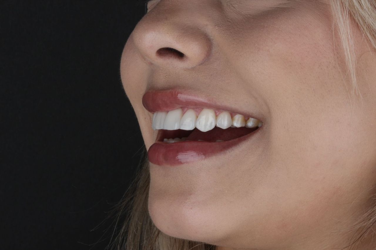 Janeth Arzate Banda-16