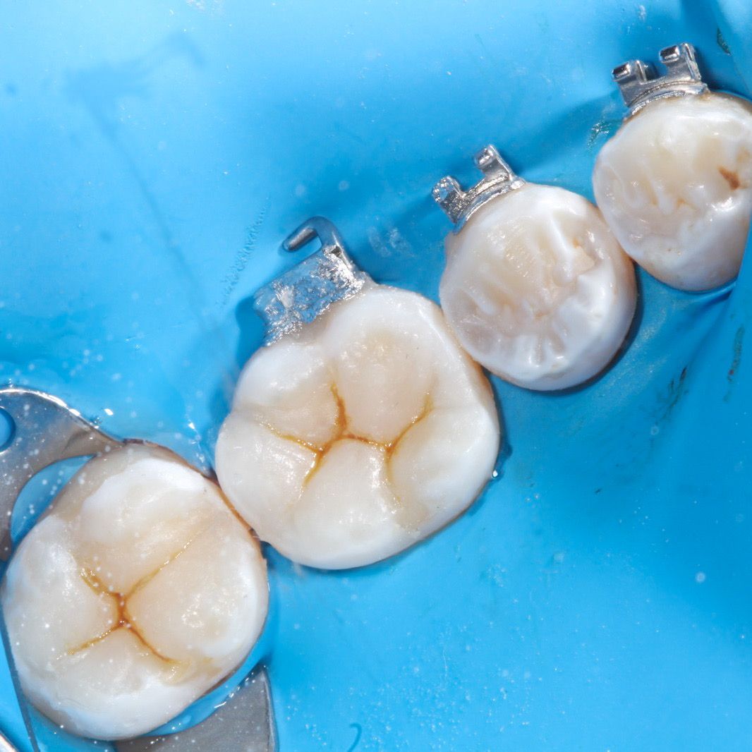 Hervin Eduardo Mendez Borrego-20