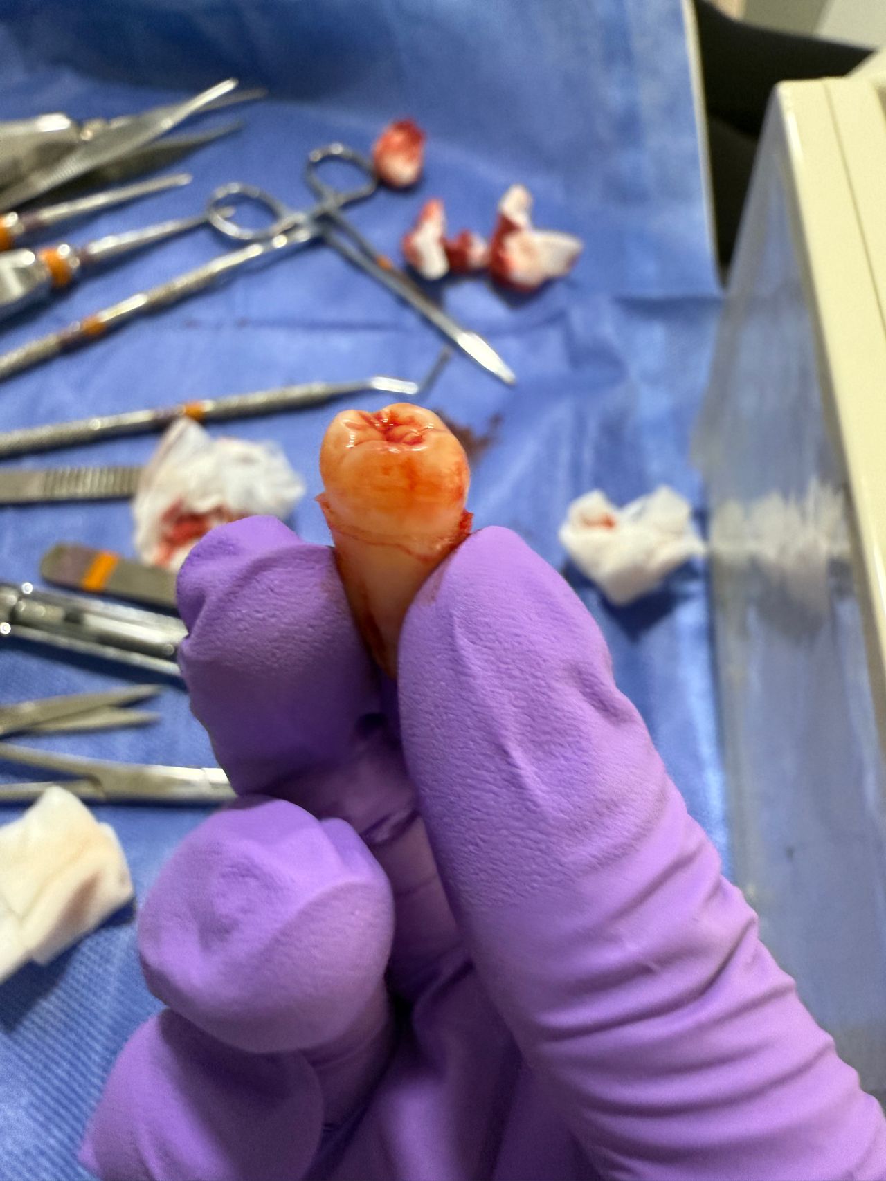 Omar Alejandro Ortiz Rodriguez-6