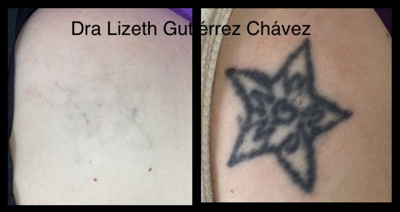 Lizeth Alejandra Gutiérrez Chavéz-3