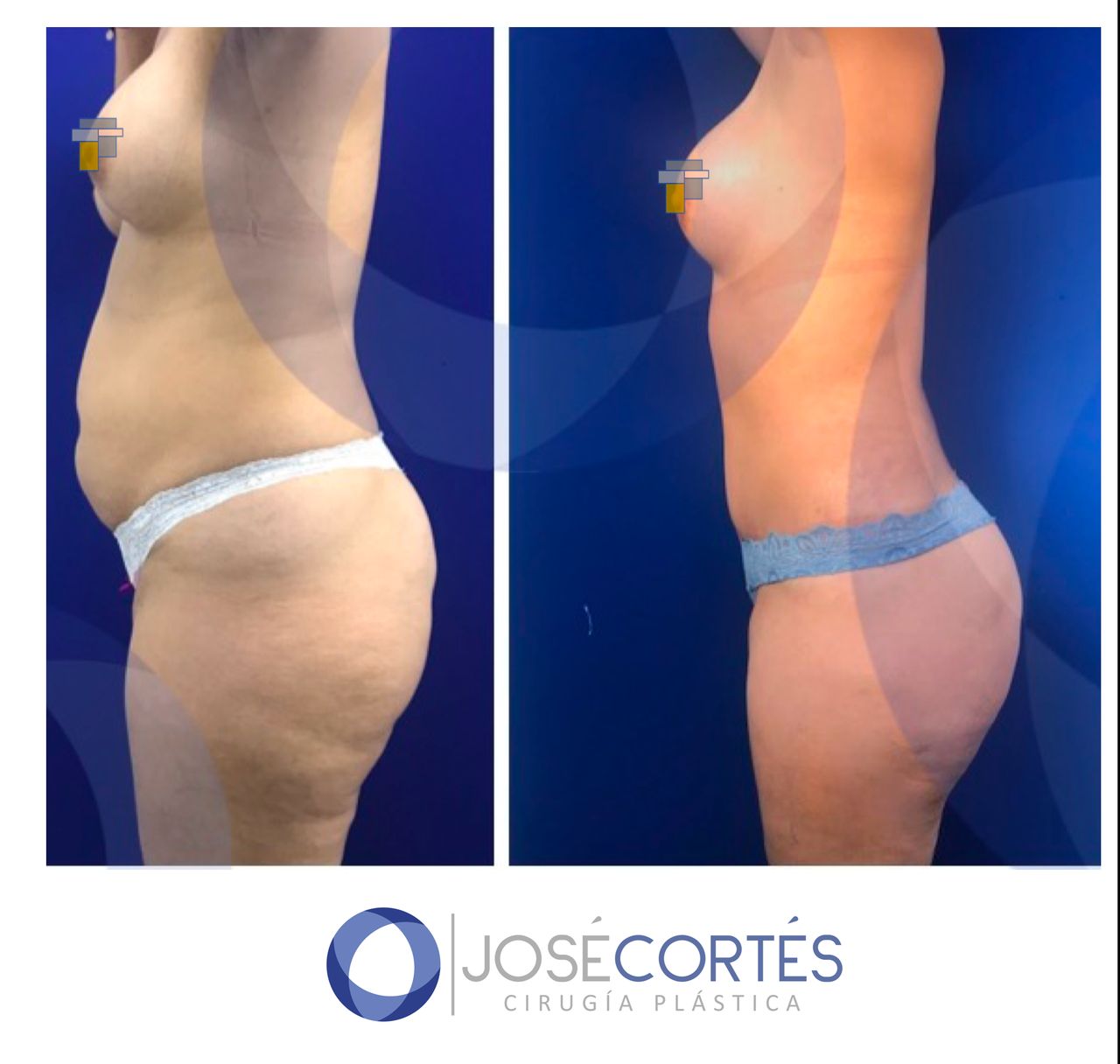 José Cortés Arreguin-12