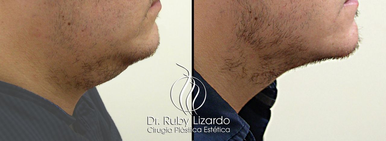 Ruby Lizardo Ramírez Robles-11