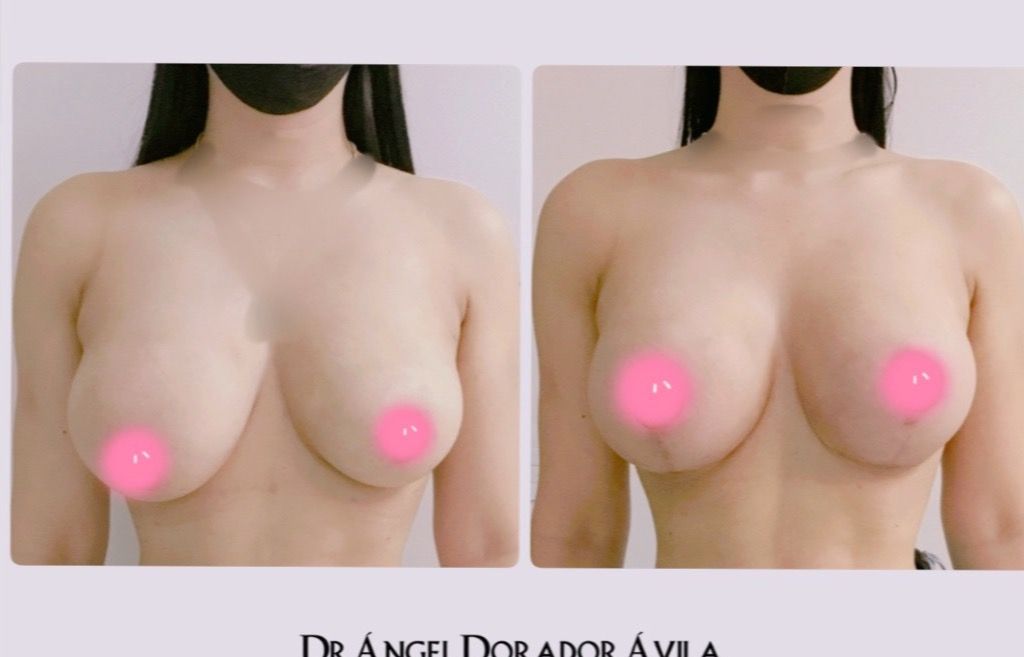 Ángel Dorador Ávila-0