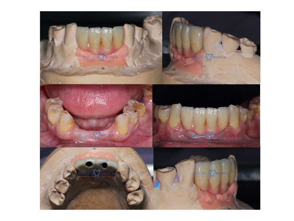 Bielmy Veronica Jonapa Peña-7