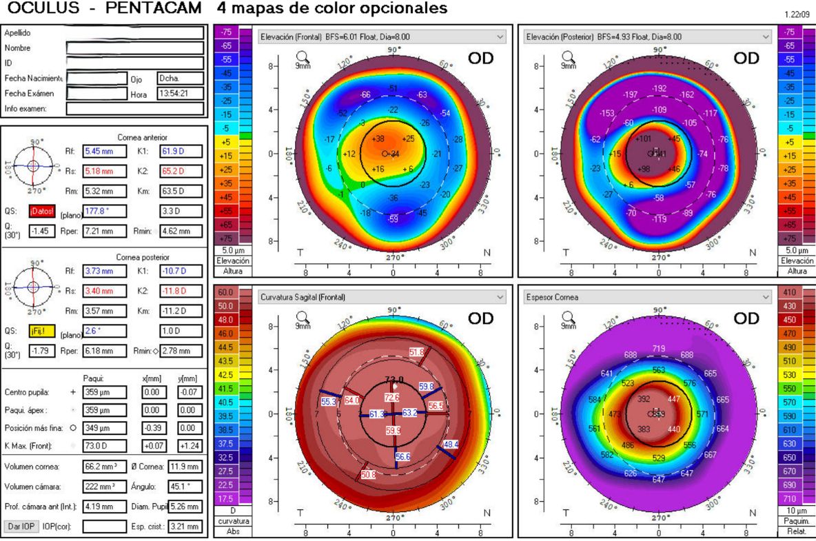 Erick Javier Ramírez Villa-11