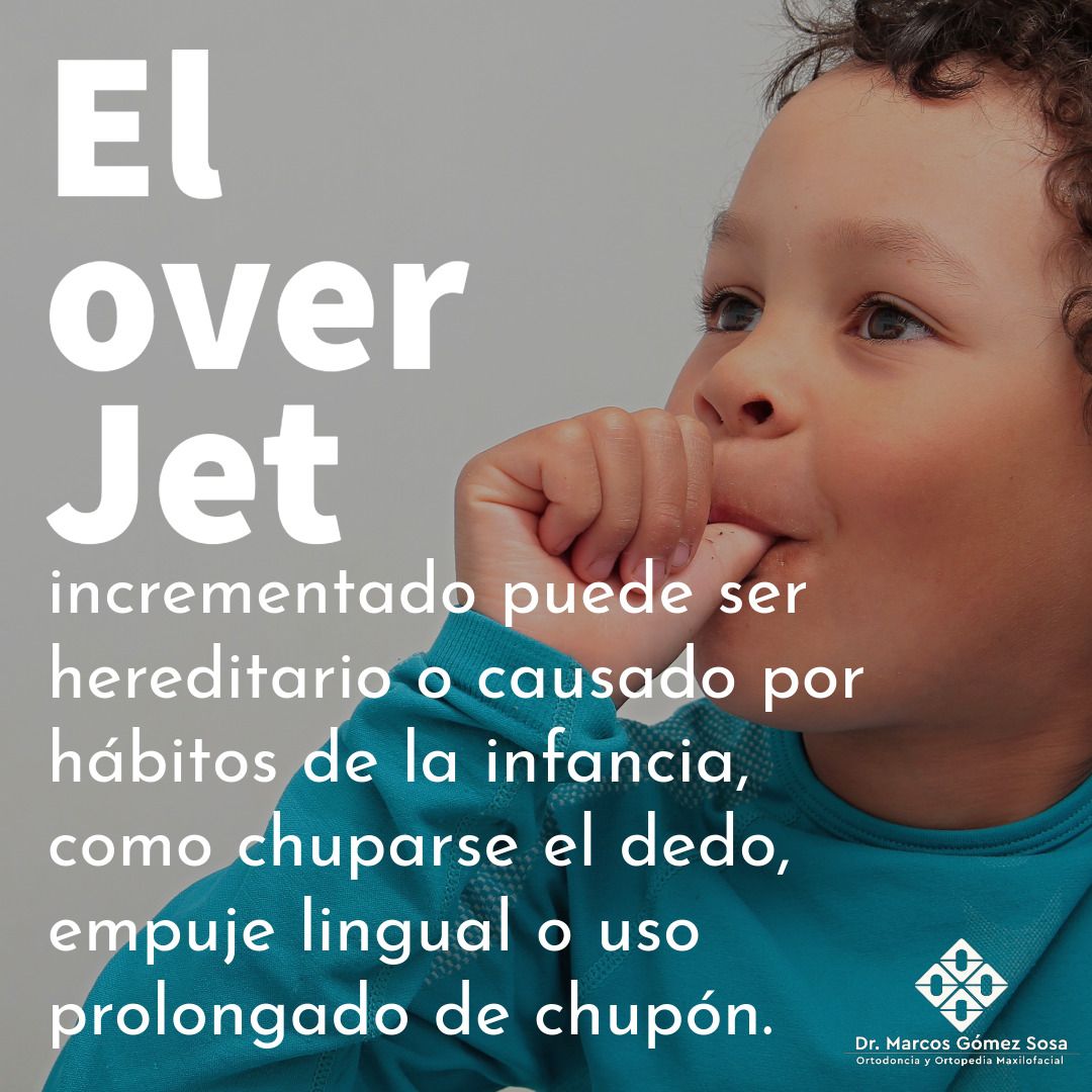 Marcos Gómez Sosa-38