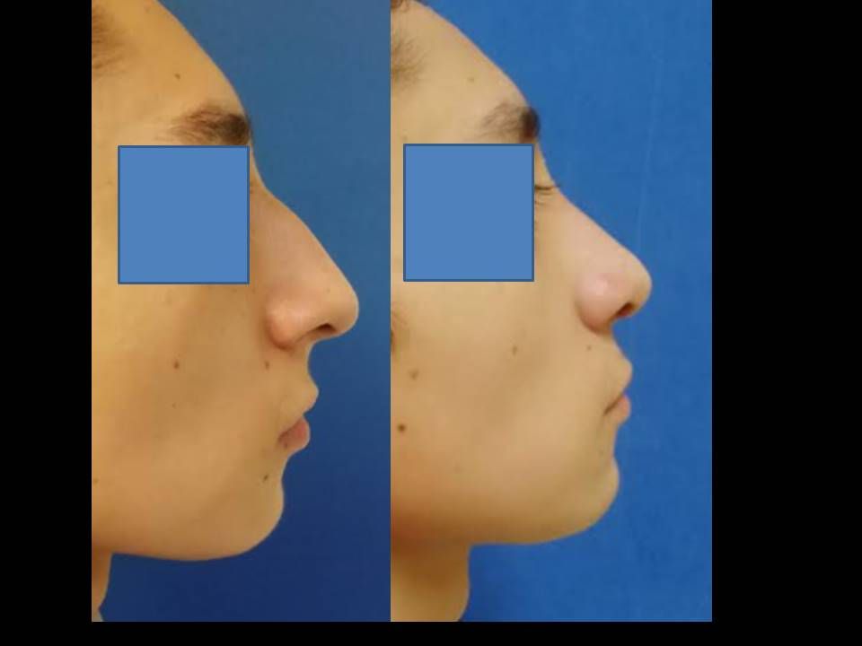 María Isabel Pérez López Burkle-0