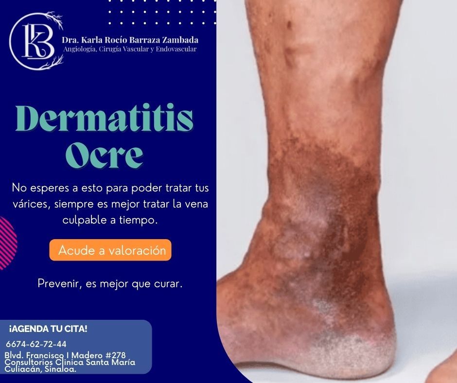 Karla Rocio Barraza Zambada-9