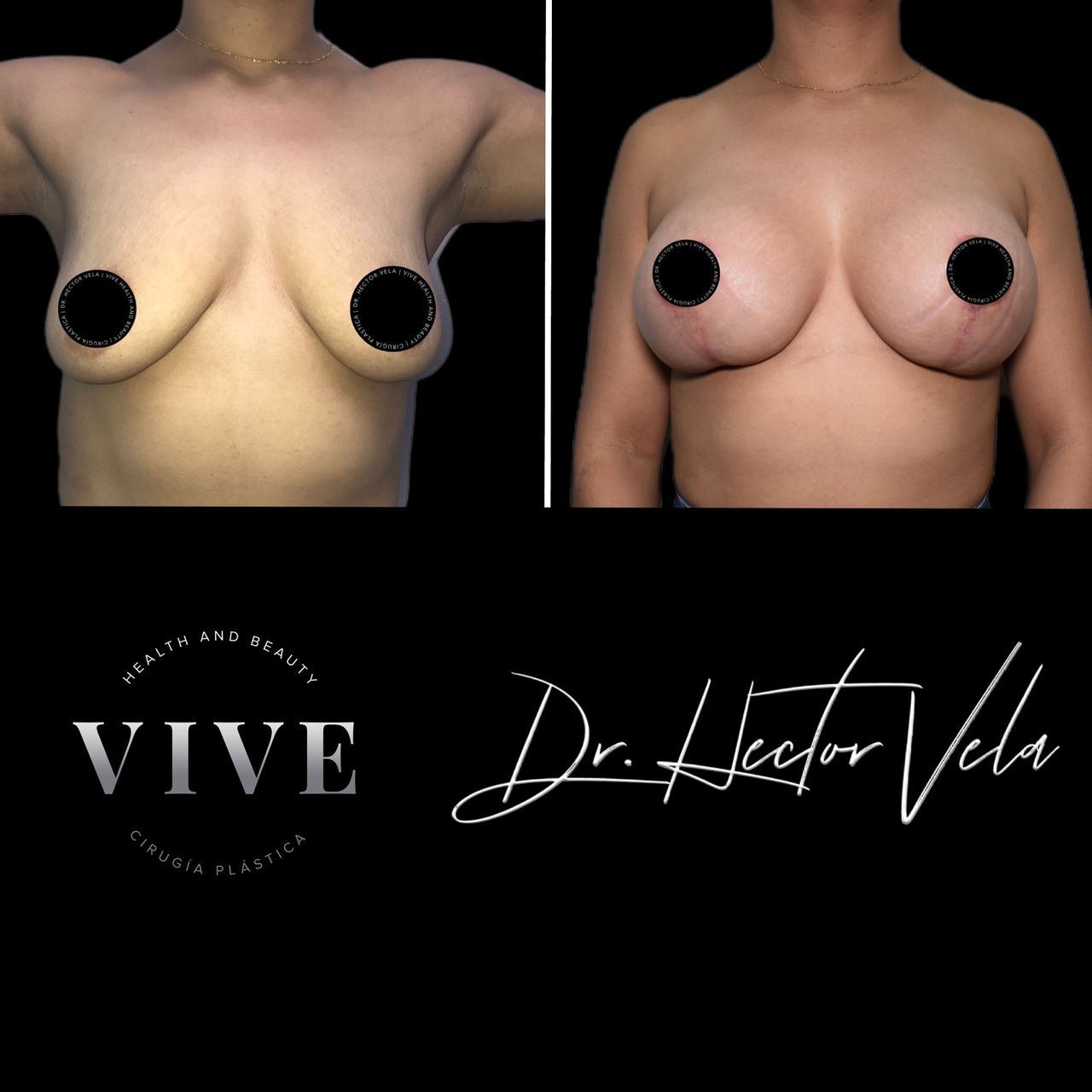 Héctor Eduardo Vela Cardona-252