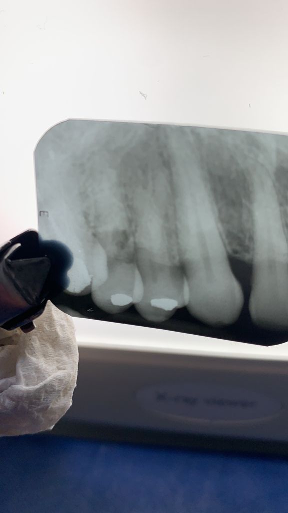 Yuriria Gochy Escalante-16