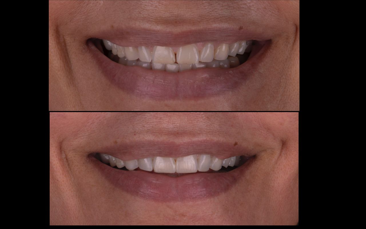 María Fernanda González Gastelum-17