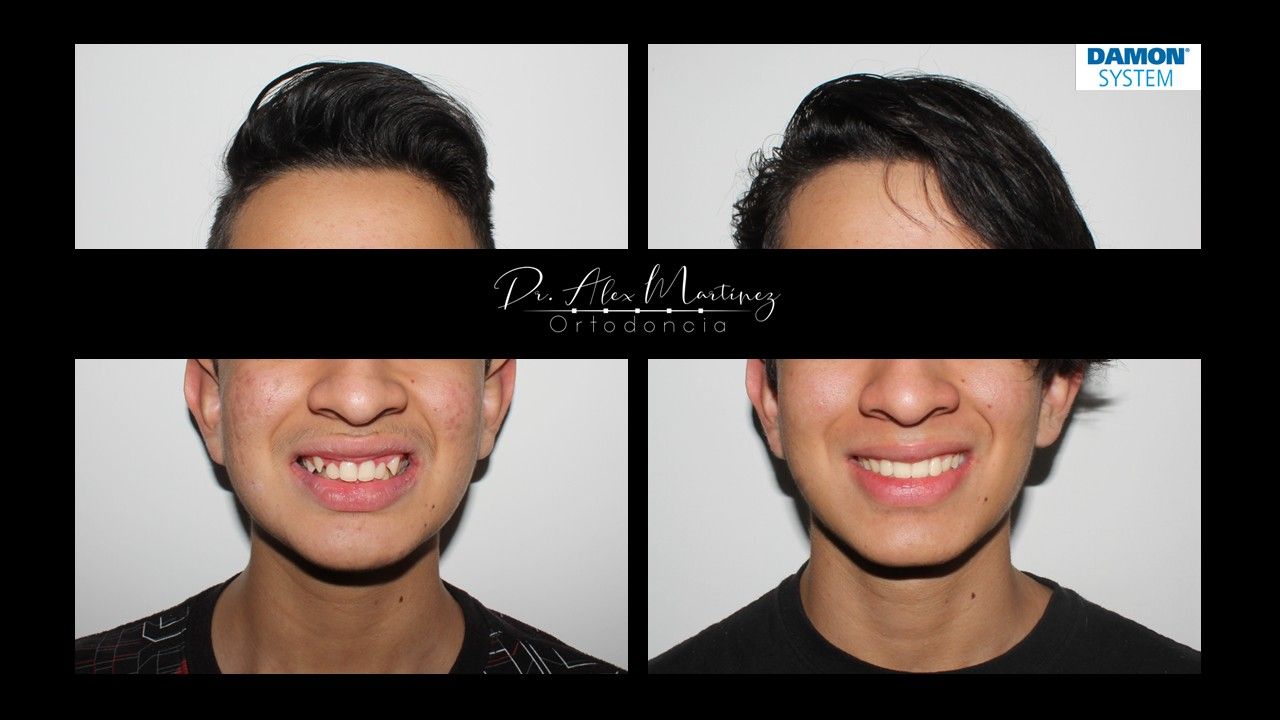 Alejandro Martínez Hernández-20