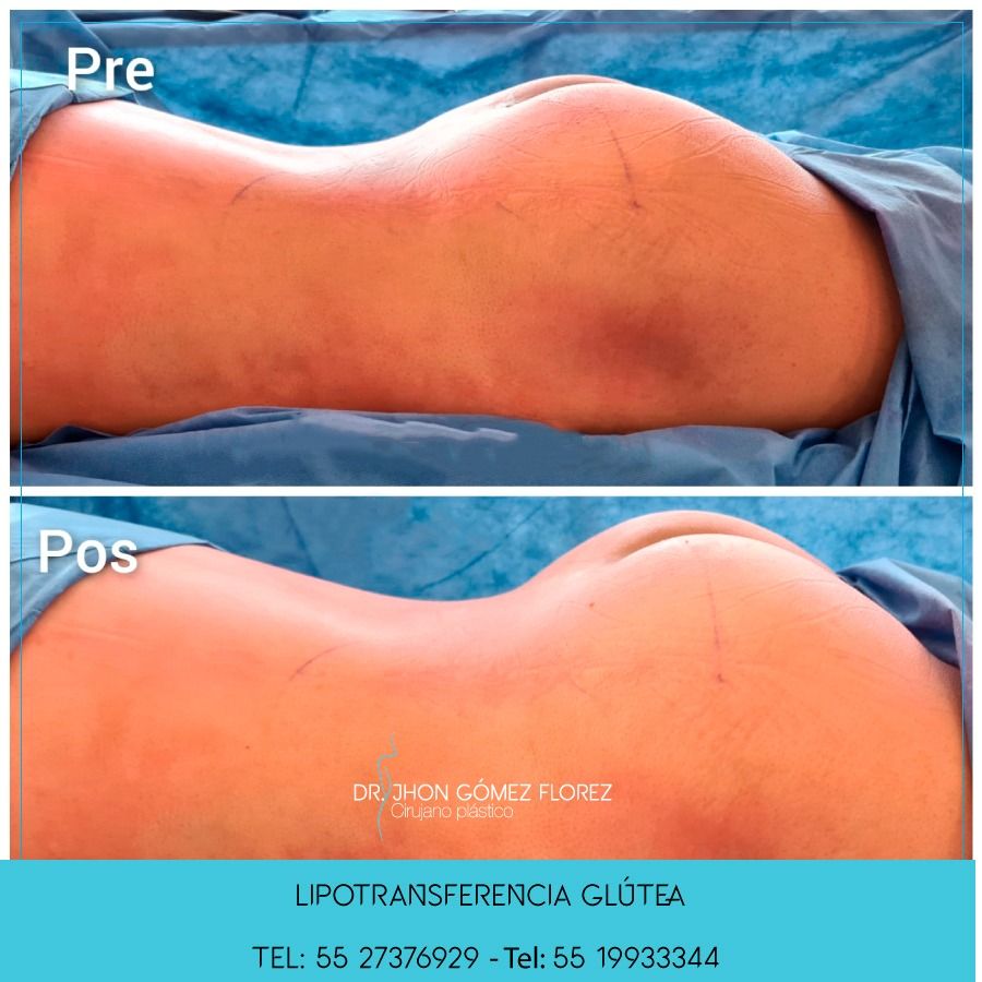 Jhon César Gómez Florez-27