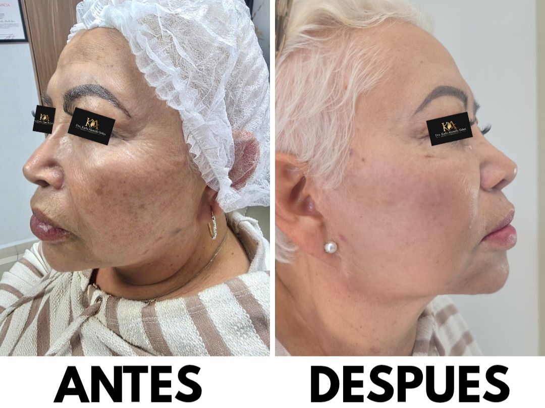 Karla Alamilla Yañez-7