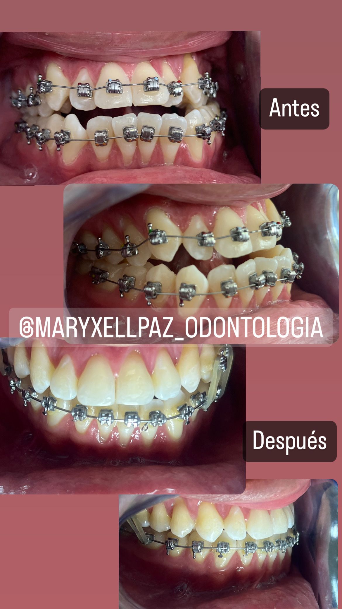 Maryxell Paz González-10