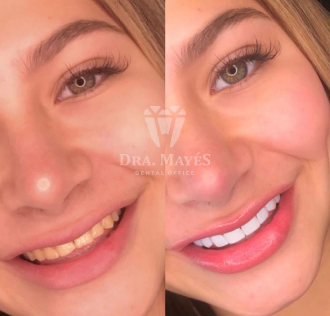 Marijose Mayes Merelles-2