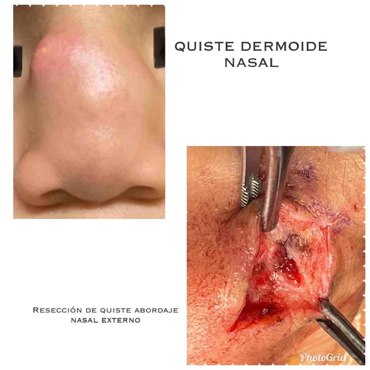 Nuria Esperanza Boronat Echeverria-16