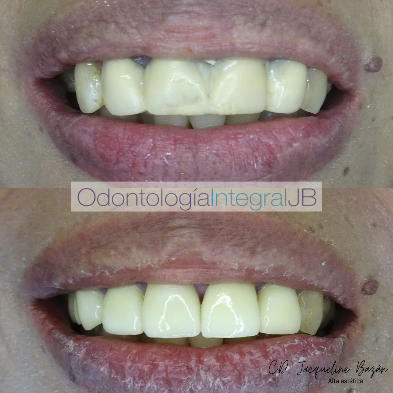 Jacqueline Bazán Díaz-12