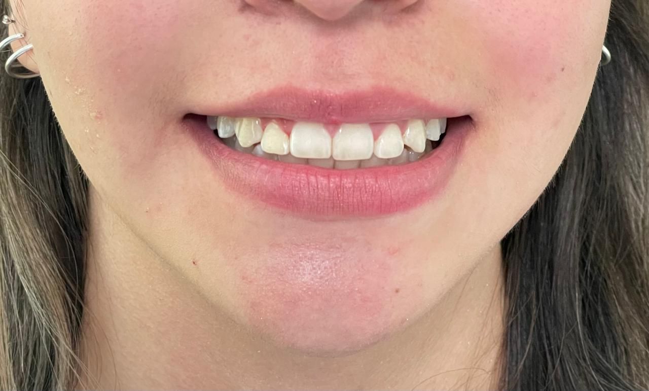 Anuar Becerril Castro-7