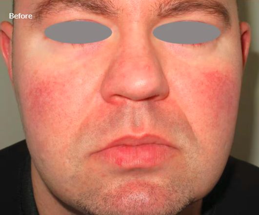 Jorge Luis Villalobos Ibarra-6