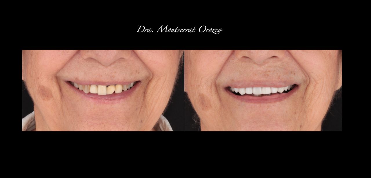 Aide Montserrat Orozco Gutierrez-50