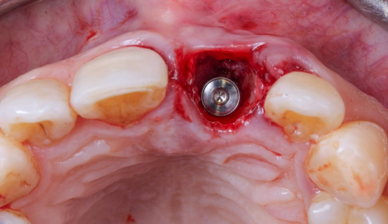 Hugo Enrique Aguilar Lamas-12