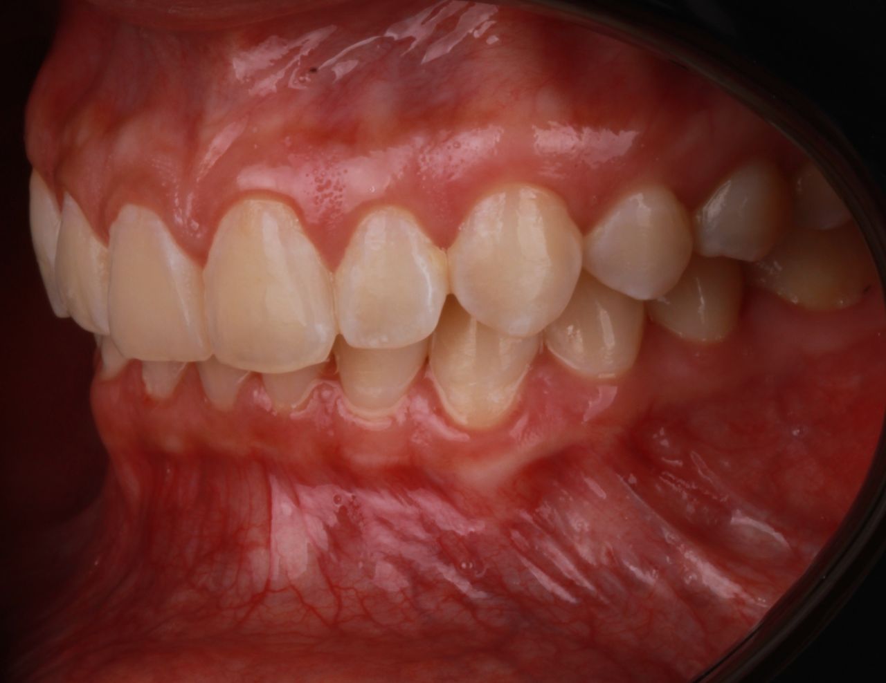 Jesus De La Cruz Ballinas-19