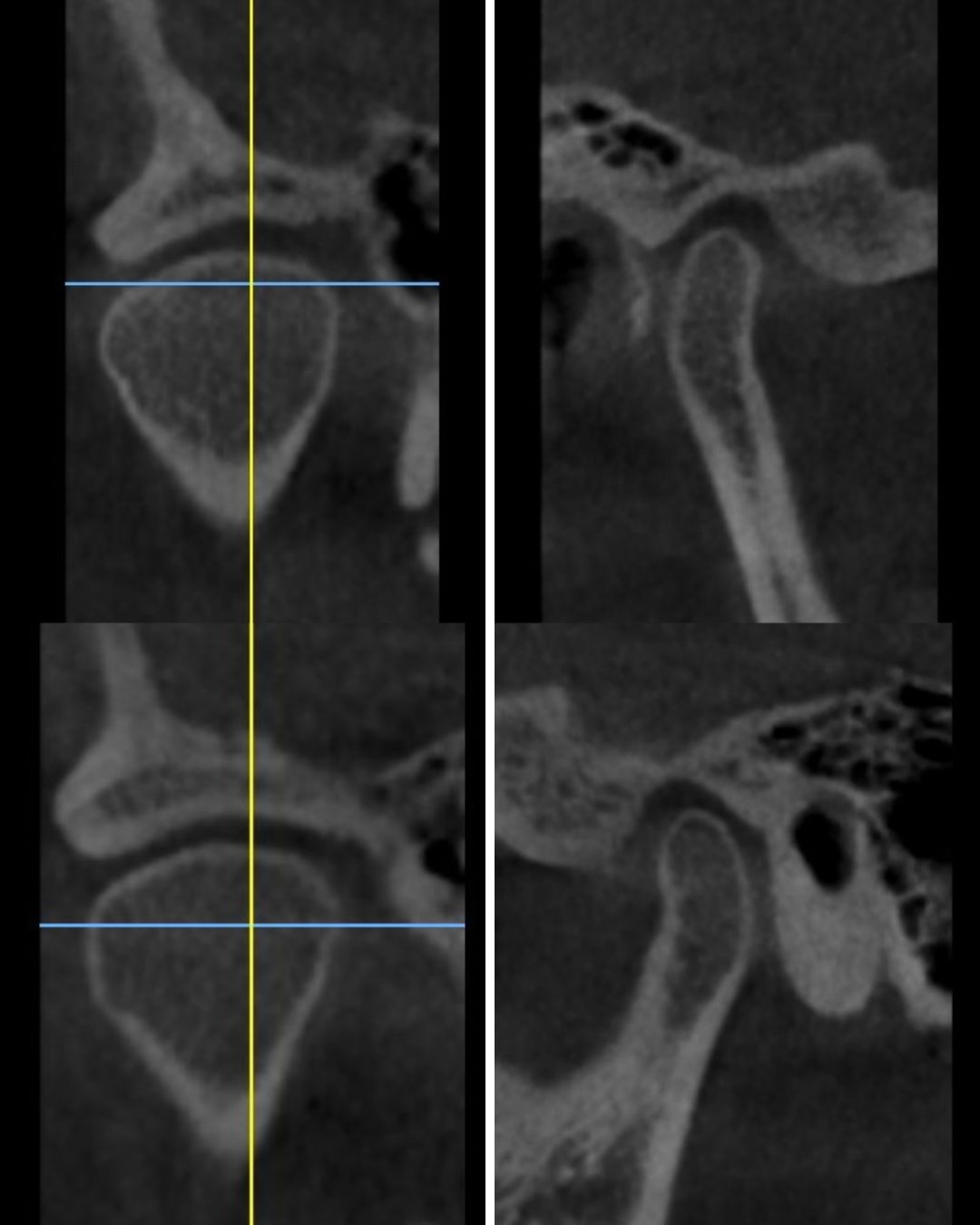 Maria Jesus Otero Lois-11