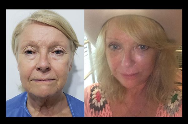 Edgar Ernesto Torres Mejía-30