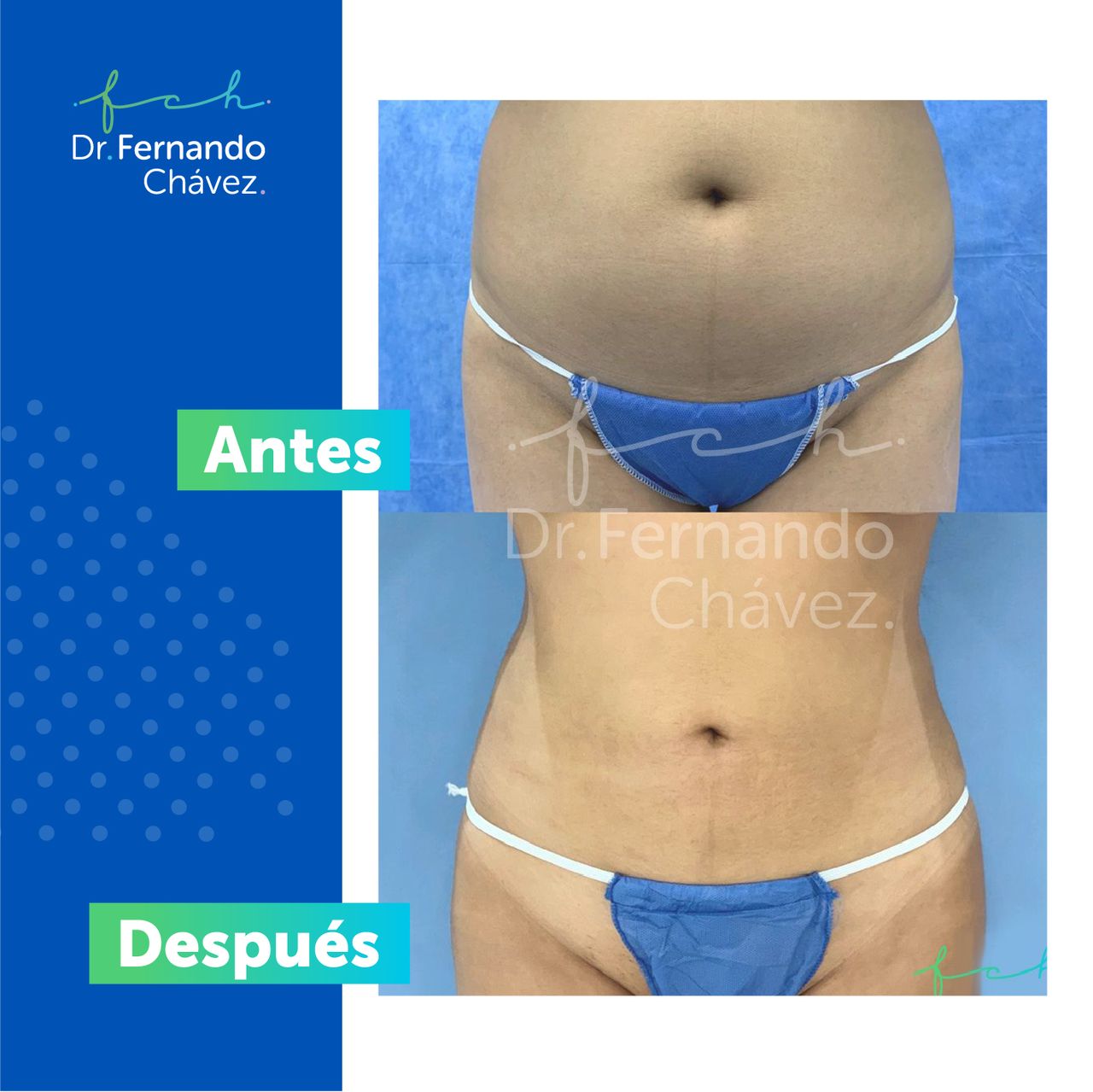 Fernando Chávez Osorio-21