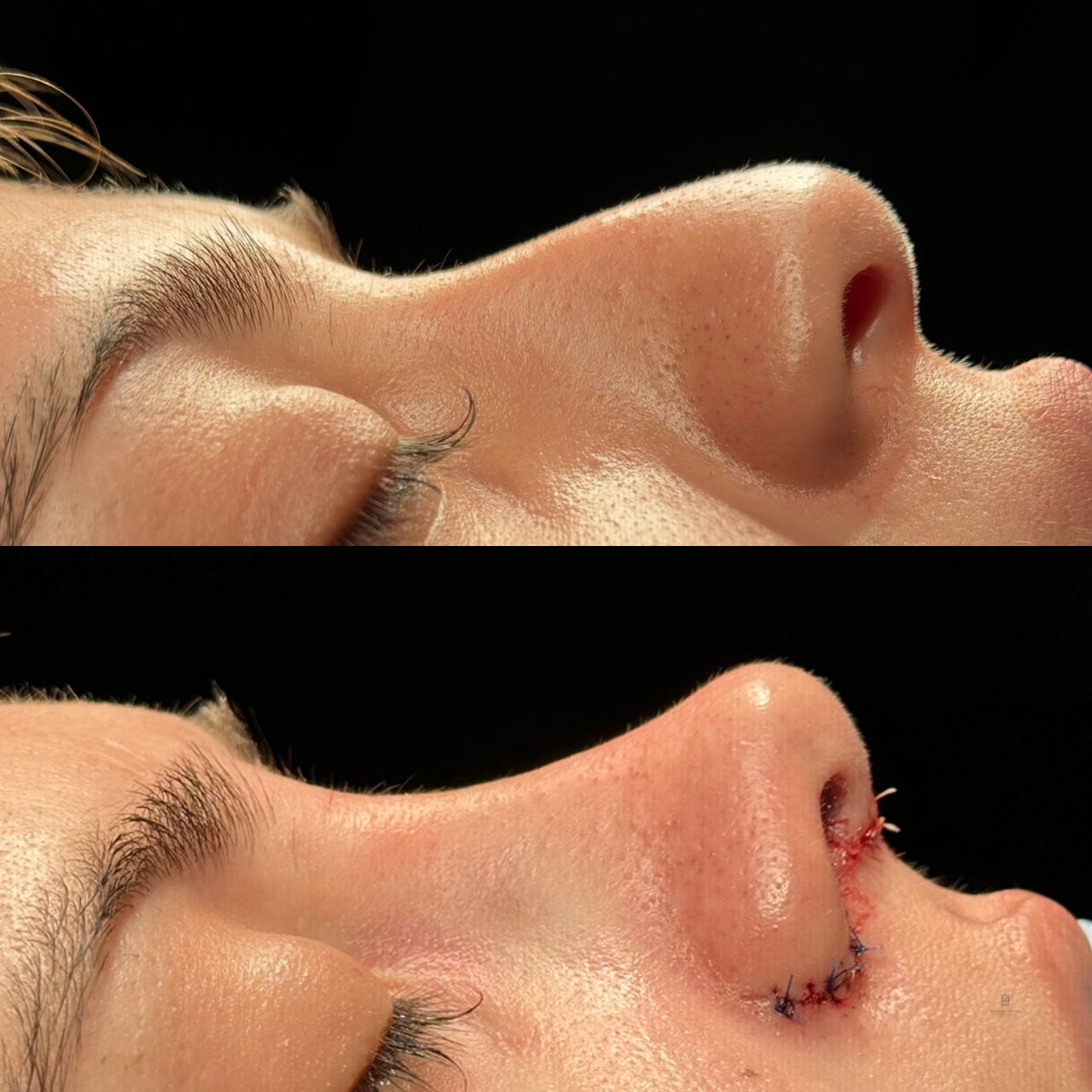 Angel Castro Urquizo-42