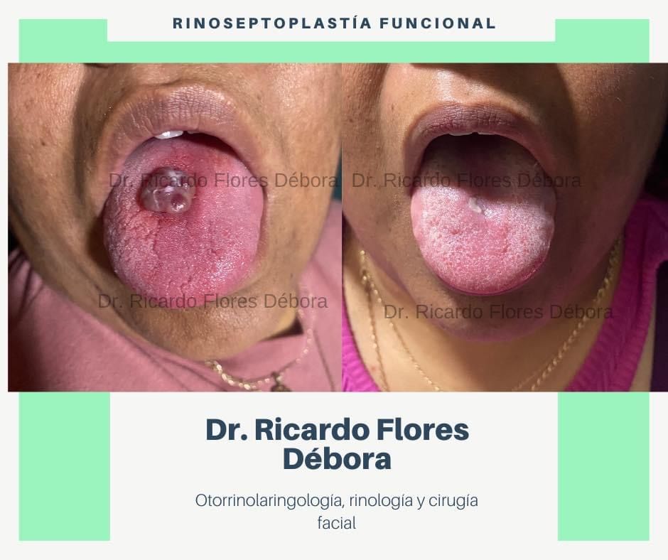 Ricardo Flores Débora-9