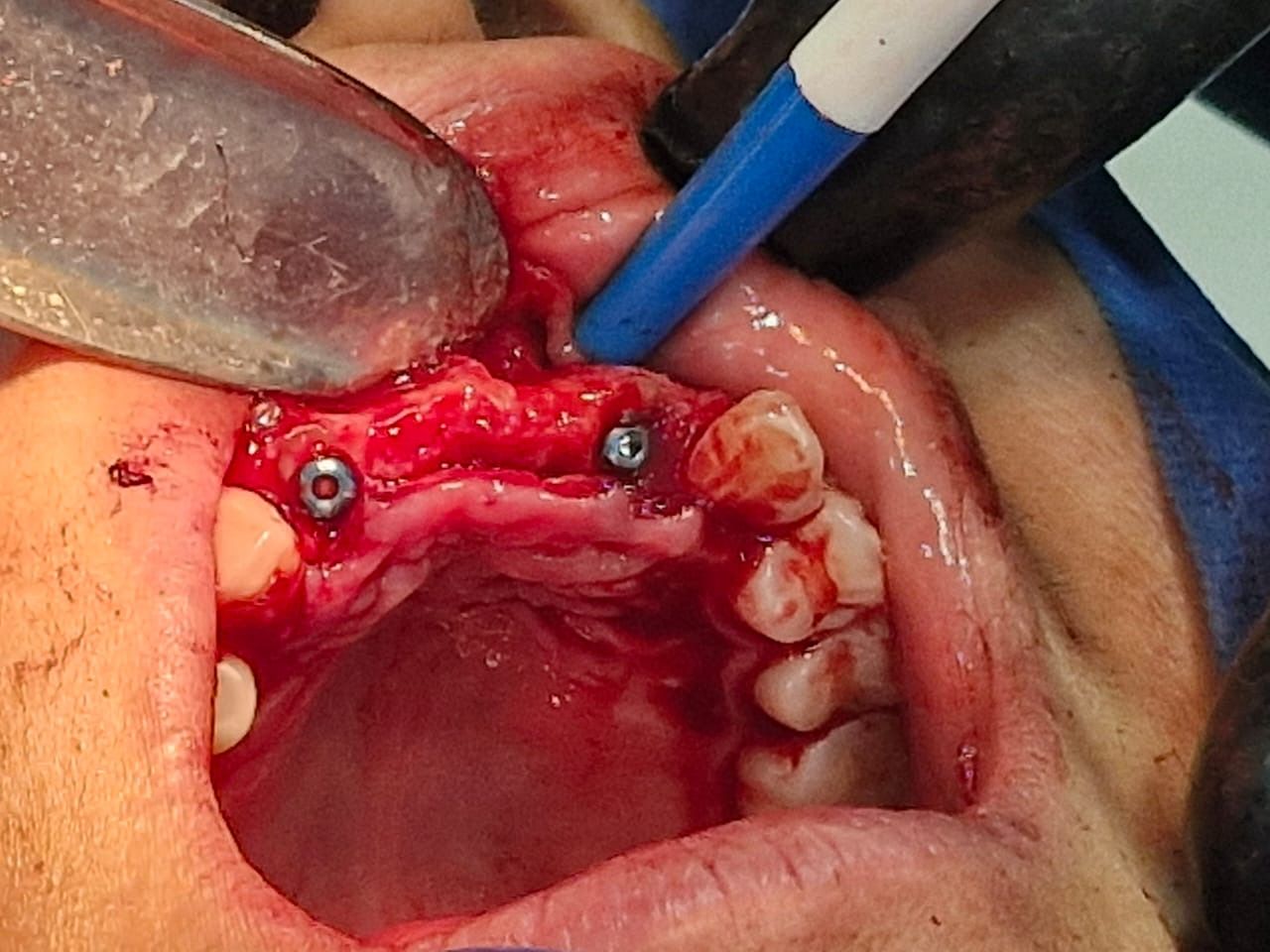 Jair Contreras García-45