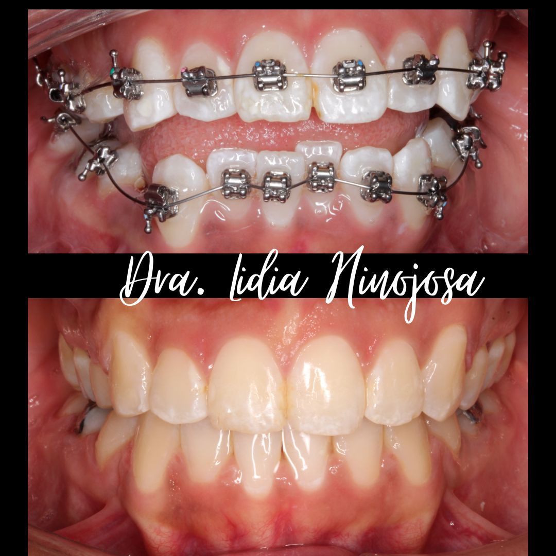 Lidia Abigail Hinojosa Arellanes-24