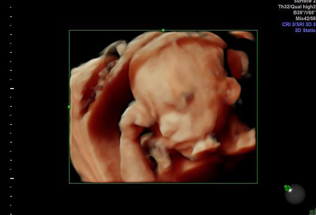 Graciela Elizabeth De La Torre Alvarez-29