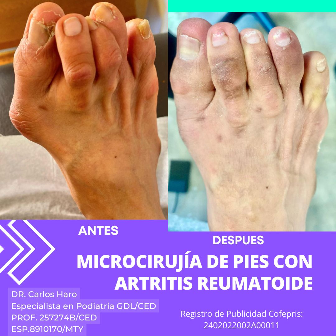 Carlos Alberto Haro Prieto-15