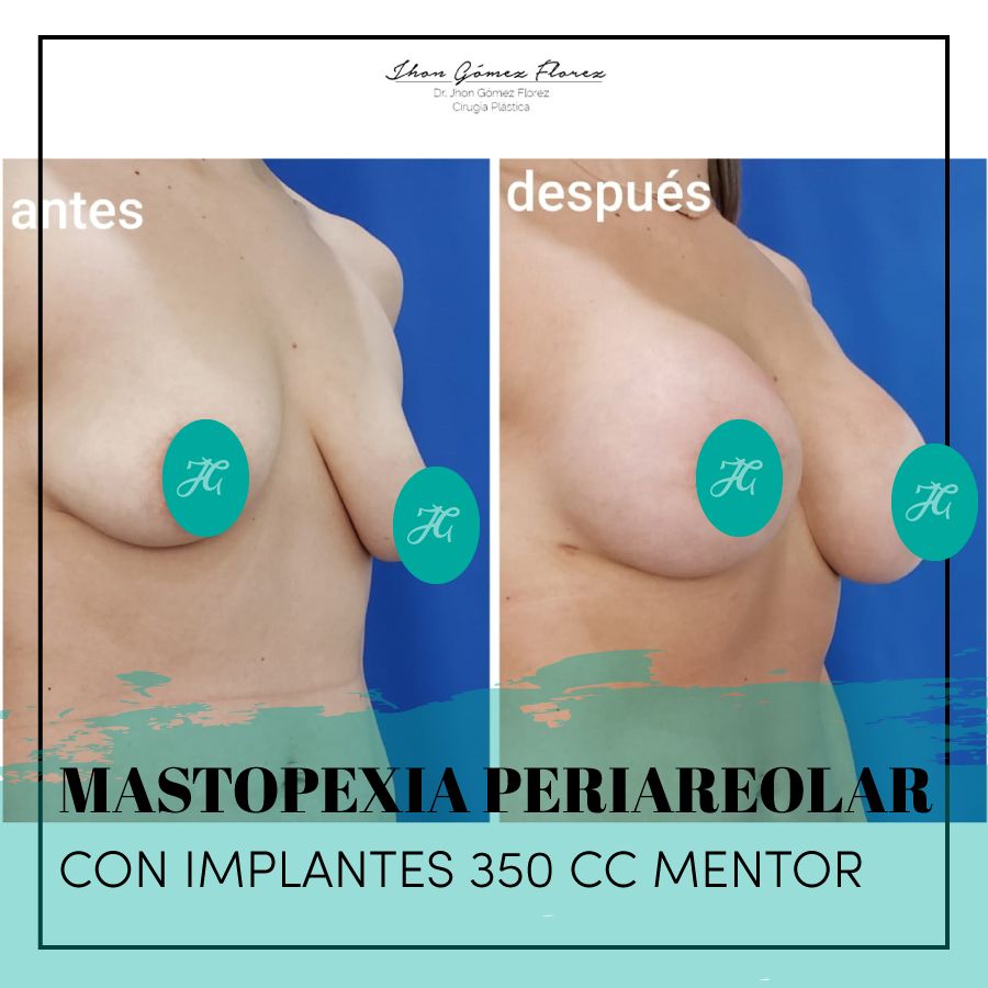 Jhon César Gómez Florez-41