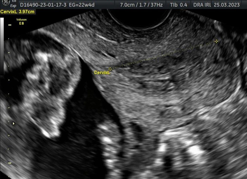 Irlanda Ayala Díaz-0