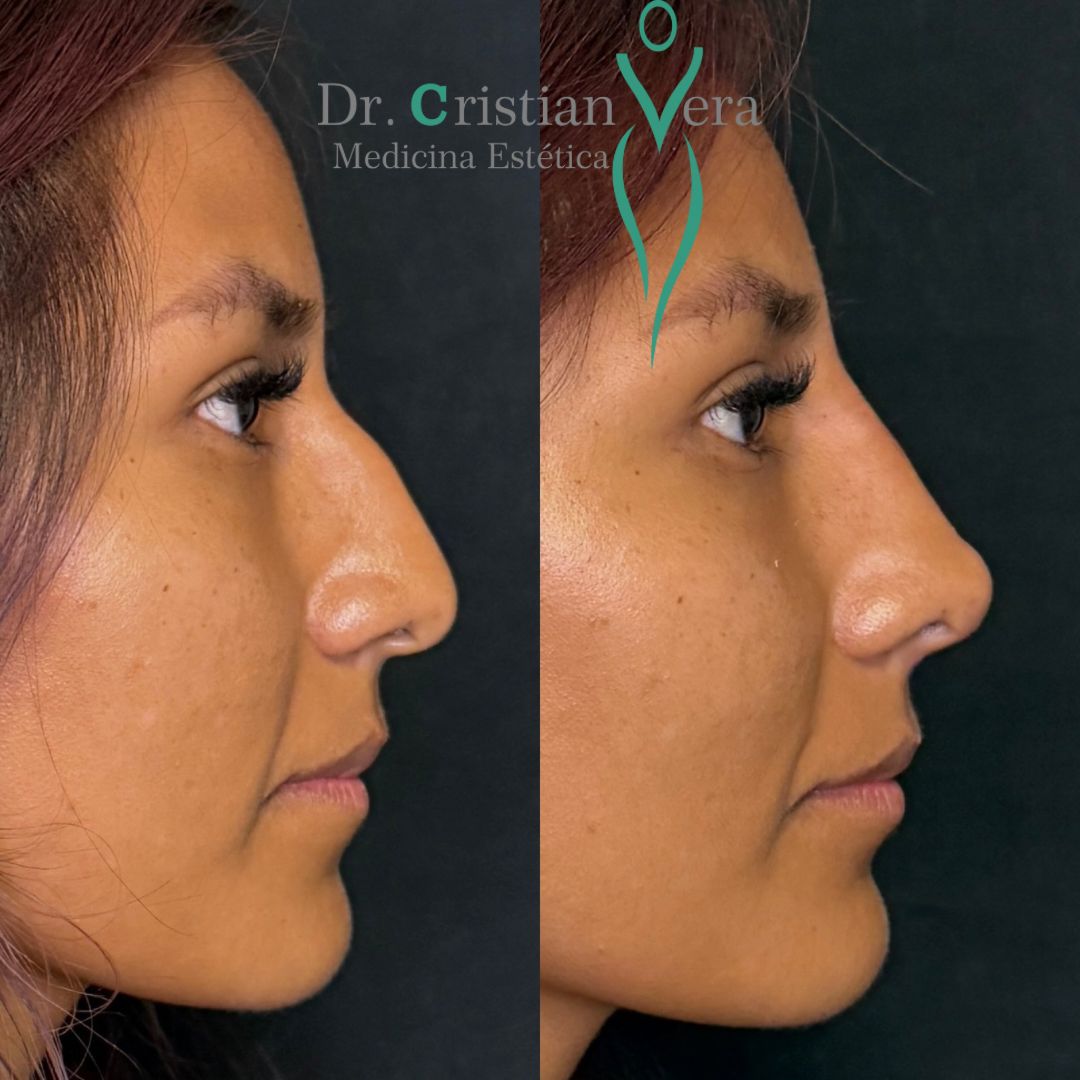 Cristian Eduardo Vera Nuño-6