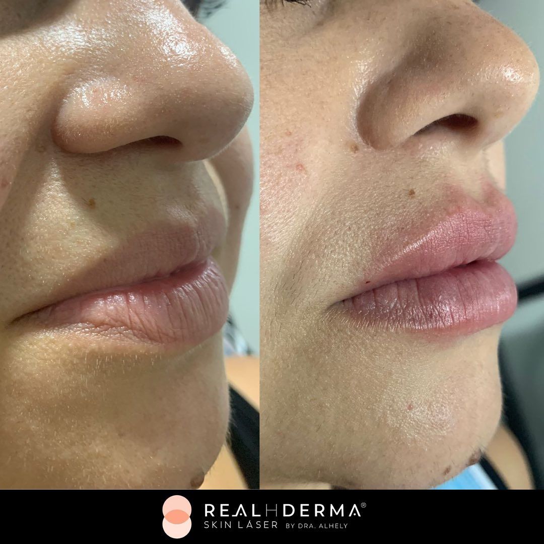 Laura Alheli Niebla Maldonado-8