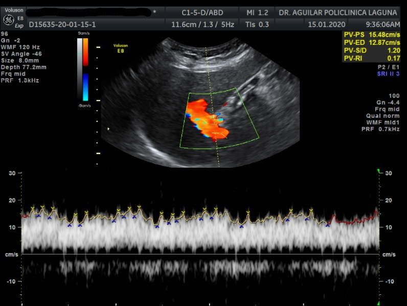Edgar Fernando Aguilar Morales-16