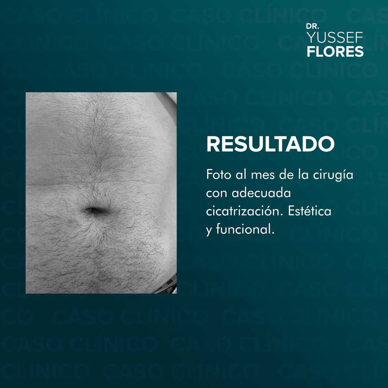 Yussef Flores López-51