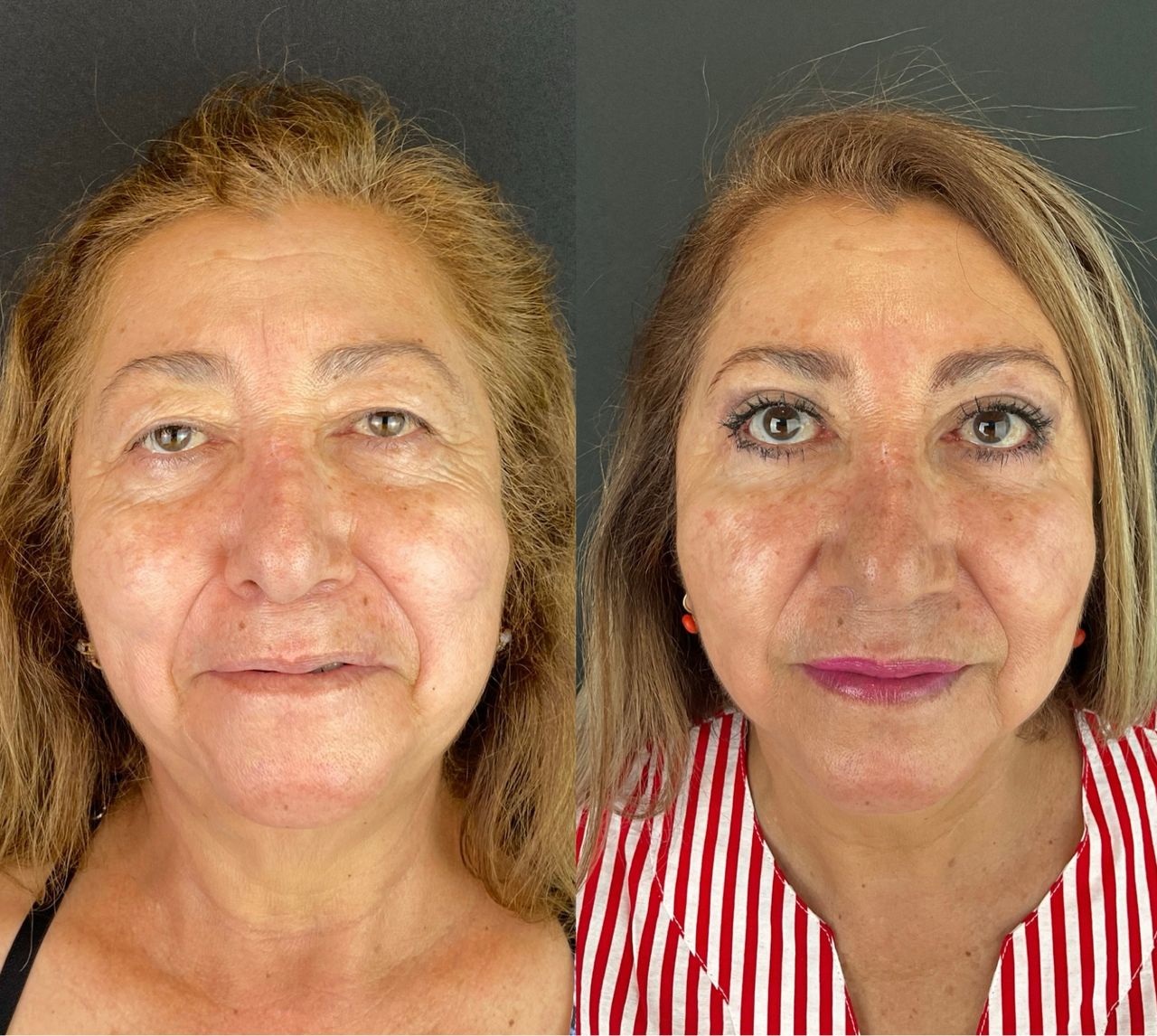 Giuseppe Tanzillo-82