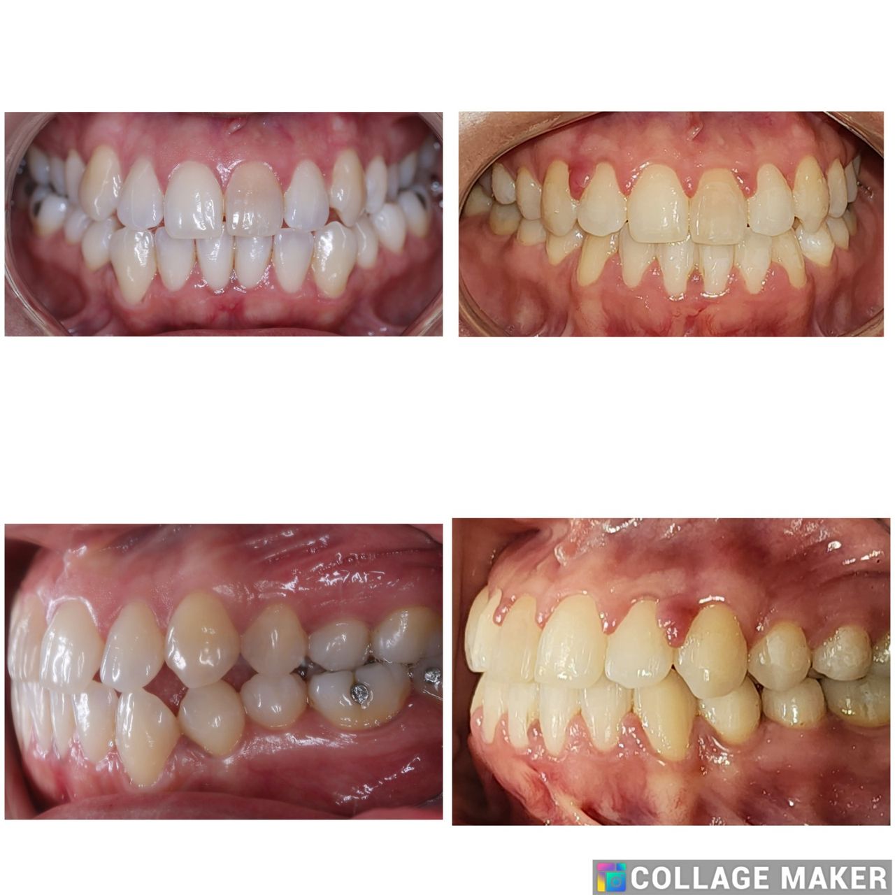 Ryan Michael Brenes Pacheco-18