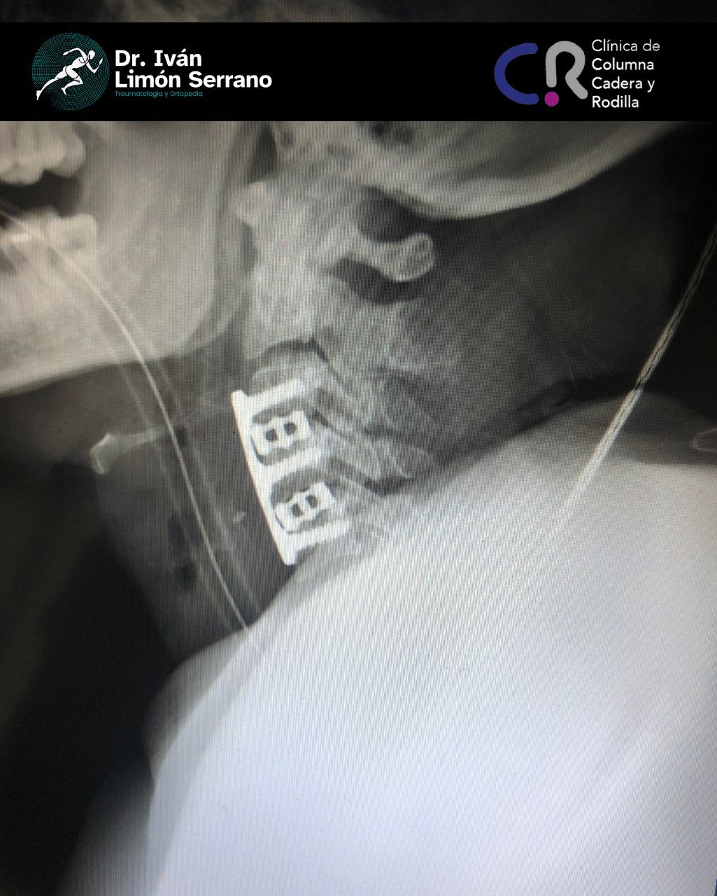 Iván Limón Serrano-27