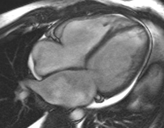 Carlos David Escobedo Uribe-2