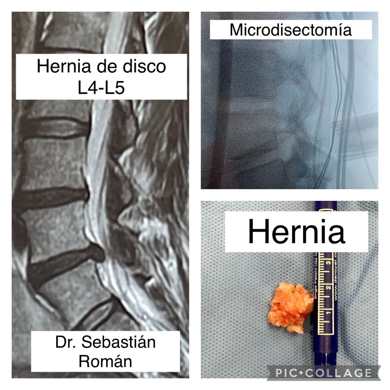 Sebastián Rodrigo Román González-10