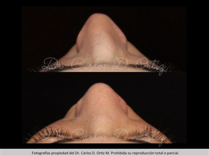 Carlos David Ortiz Moreno-29