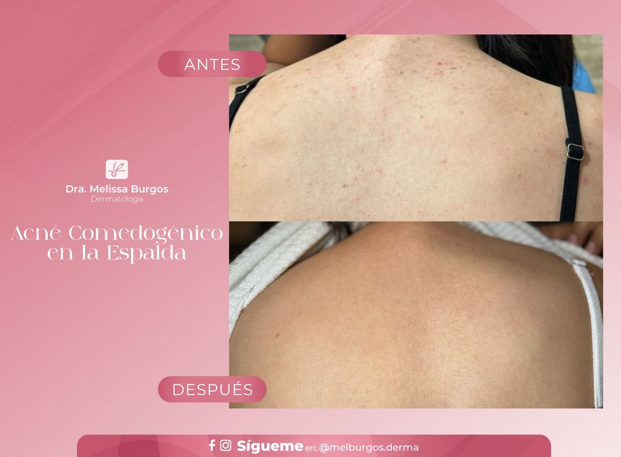 Melissa Burgos Romero-13