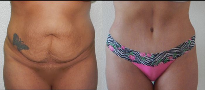 Edgar Ernesto Torres Mejía-4